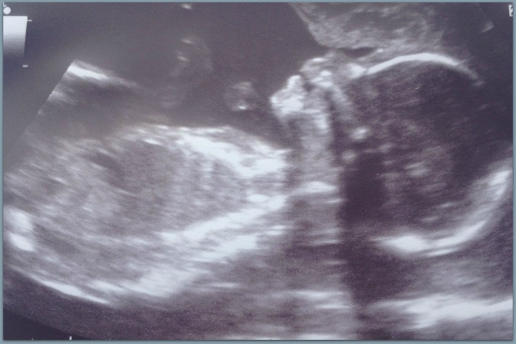 Baby boy at 20 weeks inside the womb
